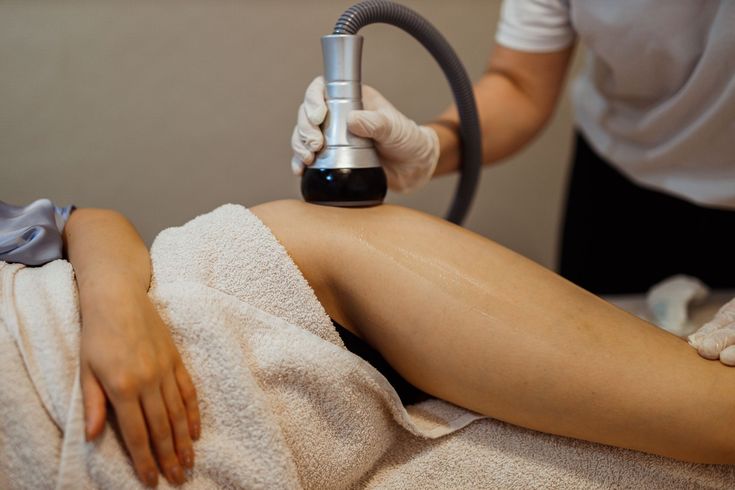Lipocavitation