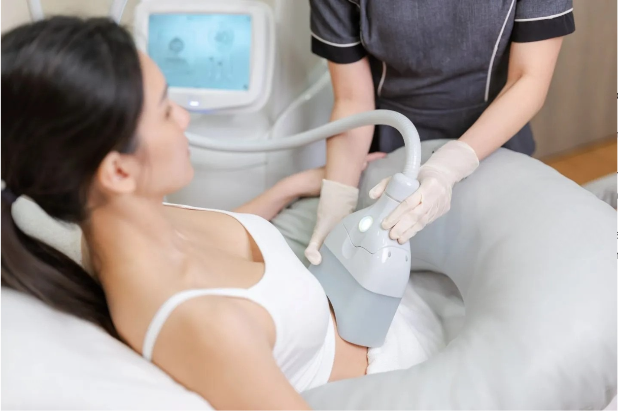 Cryolipolyse machine en action 2