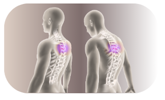 Posture